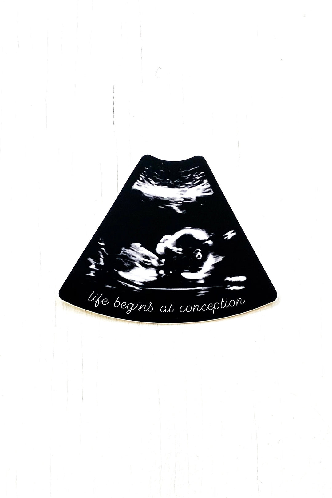 “Life Begins at Conception” Ultrasound Sticker